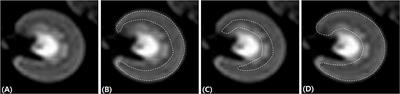 Renal Diffusion-Weighted Imaging in Healthy Dogs: Reproducibility, Test-Retest Repeatability, and Selection of the Optimal b-value Combination